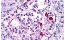 Invitrogen GIPR Polyclonal Antibody 25 &mu;g; Unconjugated:Antibodies,