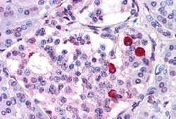 Invitrogen GIPR Polyclonal Antibody 25 &mu;g; Unconjugated:Antibodies,