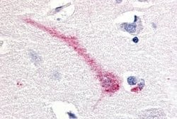 Invitrogen RON Polyclonal Antibody 25 &mu;g; Unconjugated:Antibodies, Polyclonal