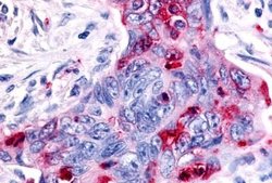 Invitrogen RON Polyclonal Antibody 25 &mu;g; Unconjugated:Antibodies, Polyclonal