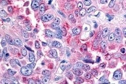 Invitrogen RON Polyclonal Antibody 25 &mu;g; Unconjugated:Antibodies, Polyclonal