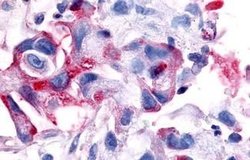 Invitrogen RON Polyclonal Antibody 25 &mu;g; Unconjugated:Antibodies, Polyclonal