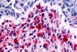 Invitrogen RON Polyclonal Antibody 25 &mu;g; Unconjugated:Antibodies, Polyclonal