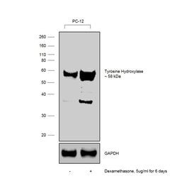 Invitrogen Tyrosine Hydroxylase Polyclonal Antibody 100 &mu;L | Buy Online | Invitrogen&trade; | Fisher Scientific