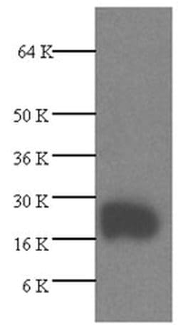 Invitrogen VEGF Polyclonal Antibody 1 mL; Unconjugated:Antibodies, Polyclonal