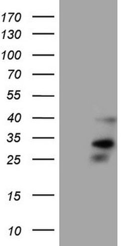 ORAI2 Mouse anti-Human, Clone: OTI8D11, lyophilized, TrueMAB 100 &mu;g;