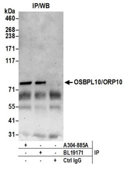 OSBPL10/ORP10 Rabbit anti-Human, Polyclonal, Bethyl Laboratories 10 &mu;l;