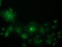 OSBPL11 Monoclonal Antibody (OTI2F6), TrueMAB , OriGene:Antibodies:Primary