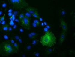 OSBPL11 Mouse anti-Canine, Human, Clone: OTI6H9, lyophilized, TrueMAB 100