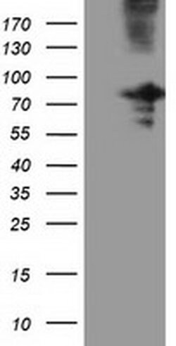 OSBPL11 Monoclonal Antibody (OTI7B3), TrueMAB , OriGene 30 &mu;L; Unconjugated:Antibodies,