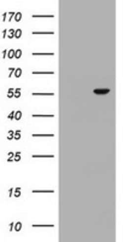 OSBPL2 Mouse anti-Human, Clone: OTI2E6, lyophilized, TrueMAB 100 &mu;g;