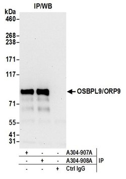 OSBPL9/ORP9 Rabbit anti-Human, Polyclonal, Bethyl Laboratories 100 &mu;l;