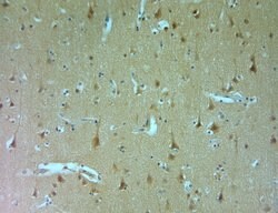 DRAM Polyclonal Antibody, Invitrogen 150 &mu;L | Buy Online | Invitrogen | Fisher Scientific