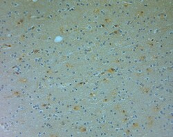 DRAM Polyclonal Antibody, Invitrogen 150 &mu;L | Buy Online | Invitrogen | Fisher Scientific