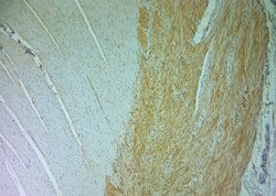 DRAM Polyclonal Antibody, Invitrogen 150 &mu;L | Buy Online | Invitrogen | Fisher Scientific