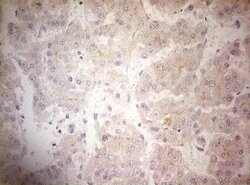 OSGIN2 Monoclonal Antibody (OTI7D12), TrueMAB , OriGene 100 &mu;L; Unconjugated:Antibodies,