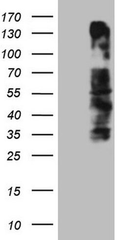 OSGIN2 Monoclonal Antibody (OTI7D12), TrueMAB , OriGene 100 &mu;L; Unconjugated:Antibodies,