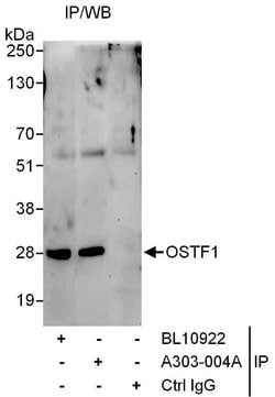 OSTF1 Rabbit anti-Human, Polyclonal, Bethyl Laboratories 100 &mu;L; Unconjugated:Antibodies,
