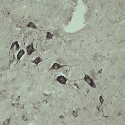 VPS45 Polyclonal Antibody, Invitrogen 500 &mu;g; Unconjugated:Antibodies,