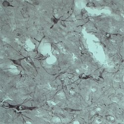 VPS45 Polyclonal Antibody, Invitrogen 500 &mu;g; Unconjugated:Antibodies,