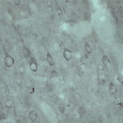 VPS45 Polyclonal Antibody, Invitrogen 500 &mu;g; Unconjugated:Antibodies,