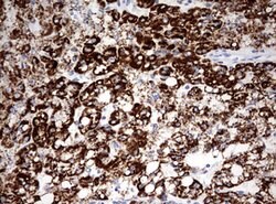 OTC Mouse anti-Human, Clone: OTI2C12, lyophilized, TrueMAB 100 &mu;g | Buy Online | Origene Technologies | Fisher Scientific