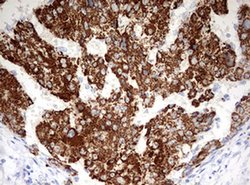 OTC Monoclonal Antibody (OTI5H8), TrueMAB , OriGene 30 &mu;L; Unconjugated:Antibodies,