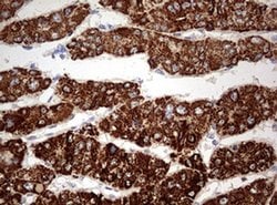 OTC Monoclonal Antibody (OTI4C9), TrueMAB , OriGene 100 &mu;L; Unconjugated:Antibodies,