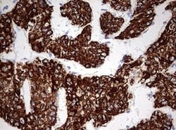 OTC Monoclonal Antibody (OTI4D6), TrueMAB , OriGene:Antibodies:Primary