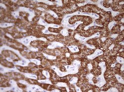 OTC Monoclonal Antibody (OTI4H2), TrueMAB , OriGene 100 &mu;L; Unconjugated:Antibodies,