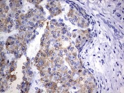 OTC Mouse anti-Human, Clone: OTI5F4, lyophilized, TrueMAB 100 &mu;g; Unconjugated:Antibodies,