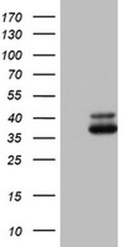 OTC Monoclonal Antibody (OTI3B9), TrueMAB , OriGene 100 &mu;L; Unconjugated:Antibodies,
