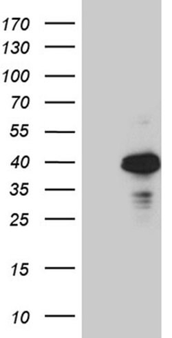 OTC Monoclonal Antibody (OTI8H9), TrueMAB , OriGene:Antibodies:Primary
