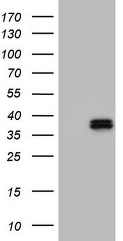 OTC Monoclonal Antibody (OTI2G6), TrueMAB , OriGene:Antibodies:Primary