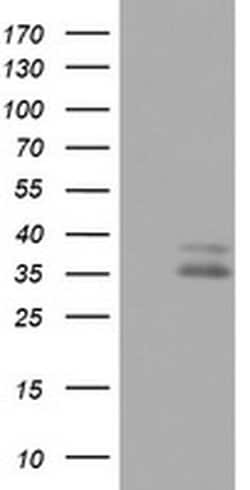 OTC Monoclonal Antibody (OTI4C9), TrueMAB , OriGene 100 &mu;L; Unconjugated:Antibodies,