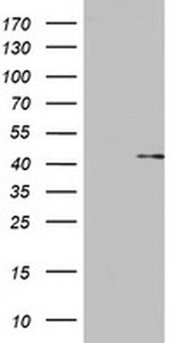 OTC Monoclonal Antibody (OTI5E4), TrueMAB , OriGene 30 &mu;L; Unconjugated:Antibodies,