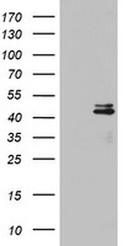 OTC Monoclonal Antibody (OTI4H2), TrueMAB , OriGene 100 &mu;L; Unconjugated:Antibodies,