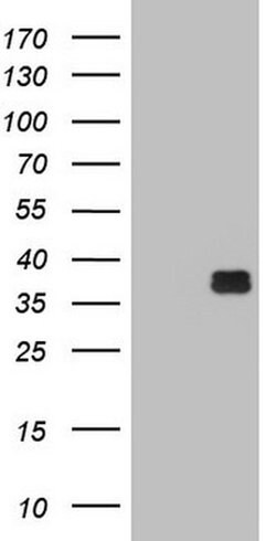 OTC Monoclonal Antibody (OTI1F3), TrueMAB , OriGene:Antibodies:Primary