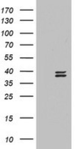 OTC Mouse anti-Human, Clone: OTI8A9, lyophilized, TrueMAB 100 &mu;g; Unconjugated:Antibodies,