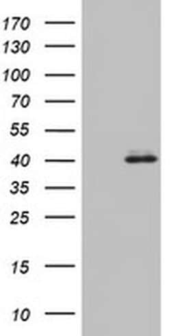 OTC Monoclonal Antibody (OTI5A7), TrueMAB , OriGene 100 &mu;L; Unconjugated:Antibodies,