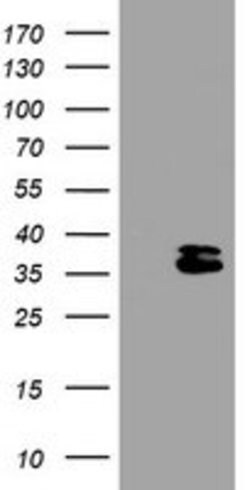 OTUB1 Mouse anti-Human, Clone: OTI1A6, lyophilized, TrueMAB 100 &mu;g;