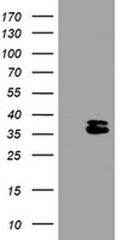 OTUB1 Monoclonal Antibody (OTI1A6), TrueMAB , OriGene 100 &mu;L; Unconjugated:Antibodies,