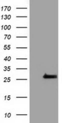 OTUB2 Mouse anti-Human, Clone: OTI6C7, lyophilized, TrueMAB 100 &mu;g;