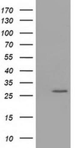 OTUB2 Monoclonal Antibody (OTI2E5), TrueMAB , OriGene 30 &mu;L; Unconjugated:Antibodies,
