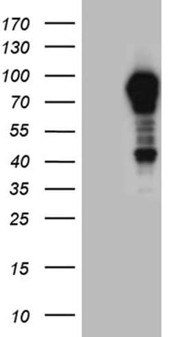 OTUD7B Monoclonal Antibody (OTI3D10), TrueMAB , OriGene 100 &mu;L | Buy Online | Origene Technologies | Fisher Scientific
