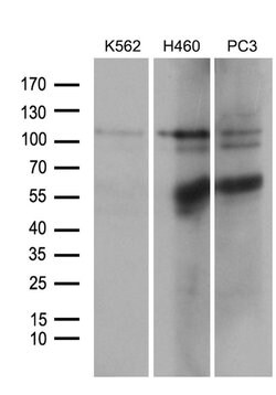 OTUD7B Monoclonal Antibody (OTI3D10), TrueMAB , OriGene 100 &mu;L | Buy Online | Origene Technologies | Fisher Scientific