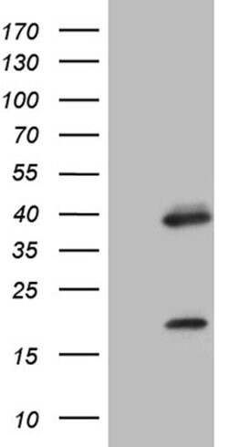 OTX2 Mouse anti-Human, Clone: OTI3G9, lyophilized, TrueMAB 100 &mu;g; Unconjugated:Antibodies,