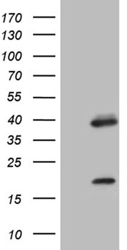 OTX2 Monoclonal Antibody (OTI3G9), TrueMAB , OriGene 100 &mu;L; Unconjugated:Antibodies,