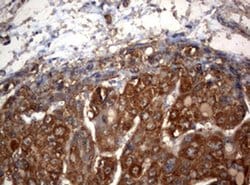 OXSM Monoclonal Antibody (OTI1H6), TrueMAB , OriGene 100 &mu;L; Unconjugated:Antibodies,
