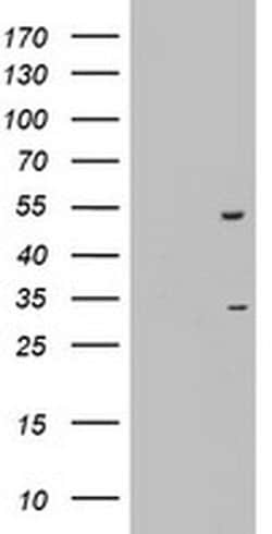 OXSM Monoclonal Antibody (OTI4E10), TrueMAB , OriGene 100 &mu;L; Unconjugated:Antibodies,